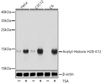 Acetyl-Histone H2B-K12 antibody