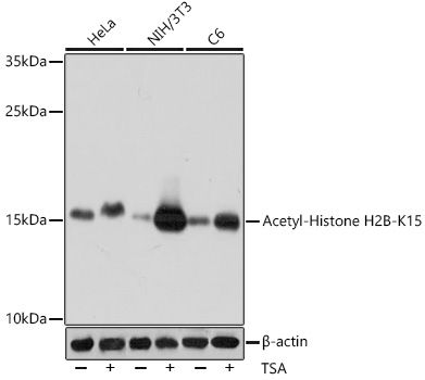 Acetyl-Histone H2B-K15 antibody