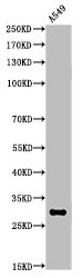 Acetyl-ATF5 (K29) antibody