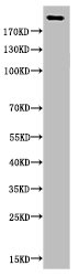 Acetyl-CREBBP (K1535) Antibody