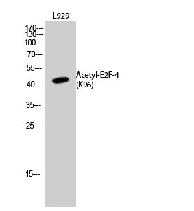 Acetyl-E2F4 (K96) antibody