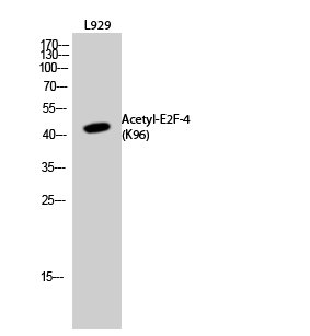 Acetyl-E2F4 (K96) Antibody