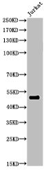 Acetyl-FOXA1 (K264/253/211) antibody
