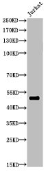 Acetyl-FOXA1 (K264/253/211) Antibody