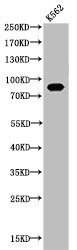 Acetyl-HSP90AA1 (K292/284) Antibody