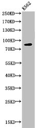 Acetyl-HSP90AA1 (K292/284) Antibody