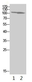 Acetyl-PARP1 (K521) Antibody