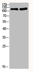 Acetyl-PARP1 (K521) Antibody