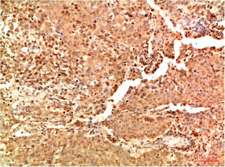 Acetyl-RELA(K314/K315) Antibody