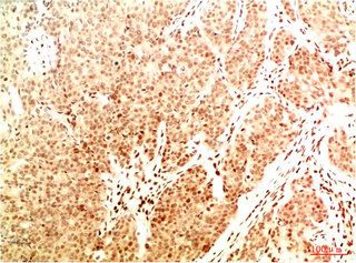 Acetyl-RELA(K314/K315) Antibody