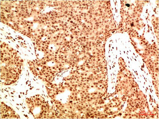 Acetyl-RELA(K314/K315) Antibody
