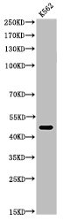 Acetyl-TUBA1A (K352) antibody