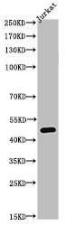 Acetyl-TUBA1A (K40) antibody