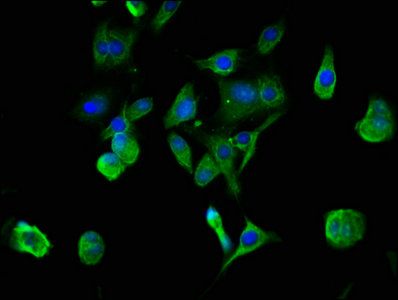 ACHE antibody