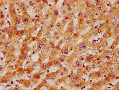 ACHE Antibody