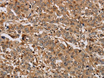 ACHE Antibody