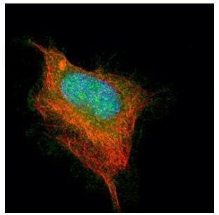 acetylcholinesterase (Cartwright blood group) Antibody