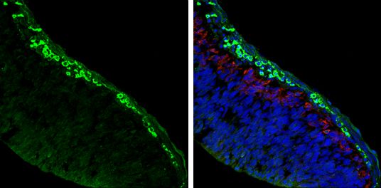 acetylcholinesterase (Cartwright blood group) Antibody