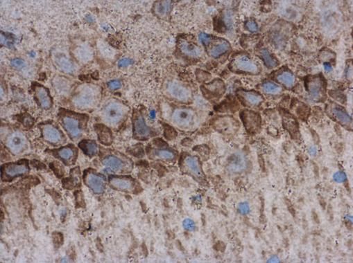 AChE antibody