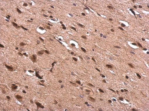 AChE antibody