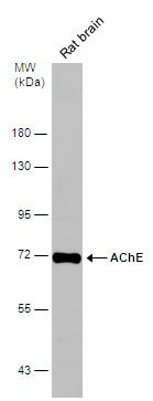 AChE antibody