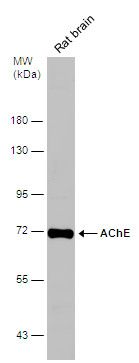 acetylcholinesterase (Cartwright blood group) Antibody