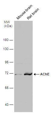 acetylcholinesterase (Cartwright blood group) Antibody