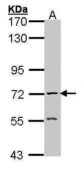 acetylcholinesterase (Cartwright blood group) Antibody