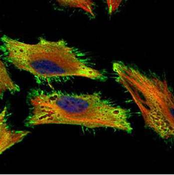 AChE antibody