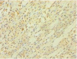 PICK1 Antibody
