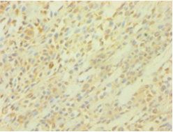 Acid-sensing ion channel 3 antibody