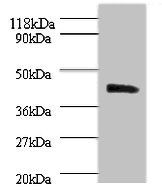 Acid-sensing ion channel 3 antibody