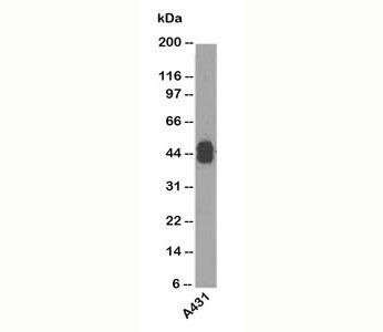Acidic Cytokeratin Antibody (LMW / Type I)
