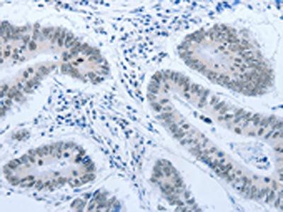 ACIN1 Antibody