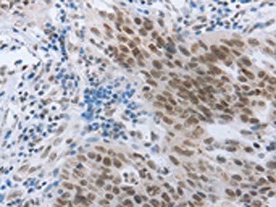 ACIN1 Antibody
