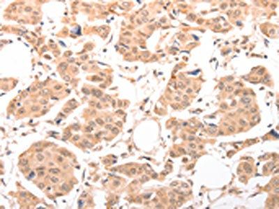 ACIN1 Antibody