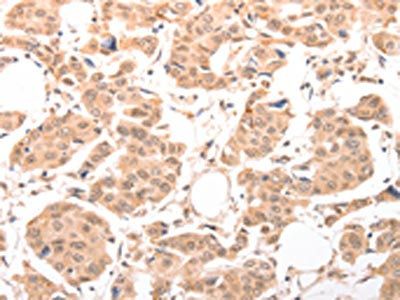 ACIN1 antibody