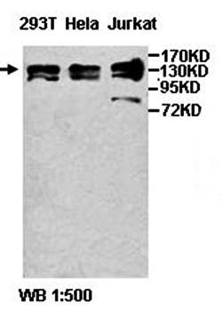 Acinus Rabbit Polyclonal Antibody