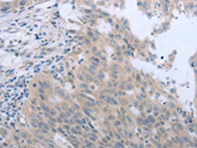 TNK2 Antibody