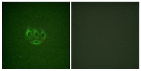 ACK1 (Phospho-Tyr284) Antibody
