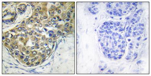 ACK1 (Phospho-Tyr284) Antibody