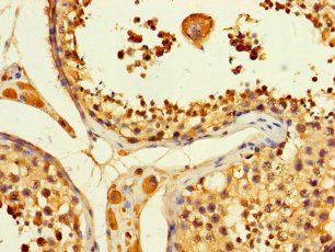 ACLY Antibody