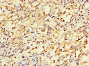 ACLY Antibody