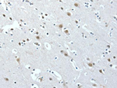 ACLY Antibody