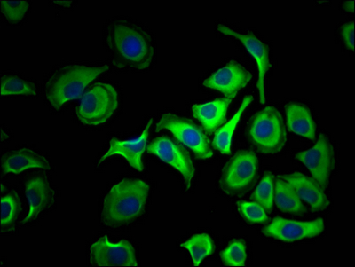 ACLY Recombinant Monoclonal Antibody
