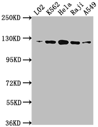 ACLY Recombinant Monoclonal Antibody