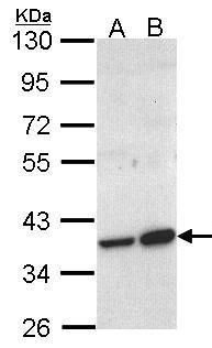 ACMSD antibody [N2C3]