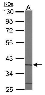ACMSD antibody [N2C3]