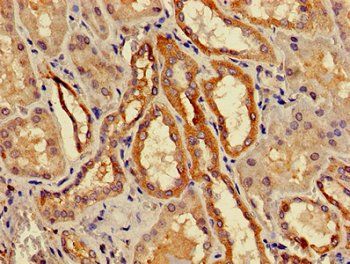 ACMSD Antibody