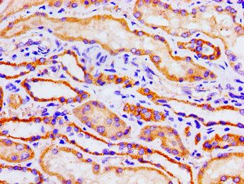 ACO1 Antibody